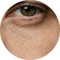 Flushes Puffiness